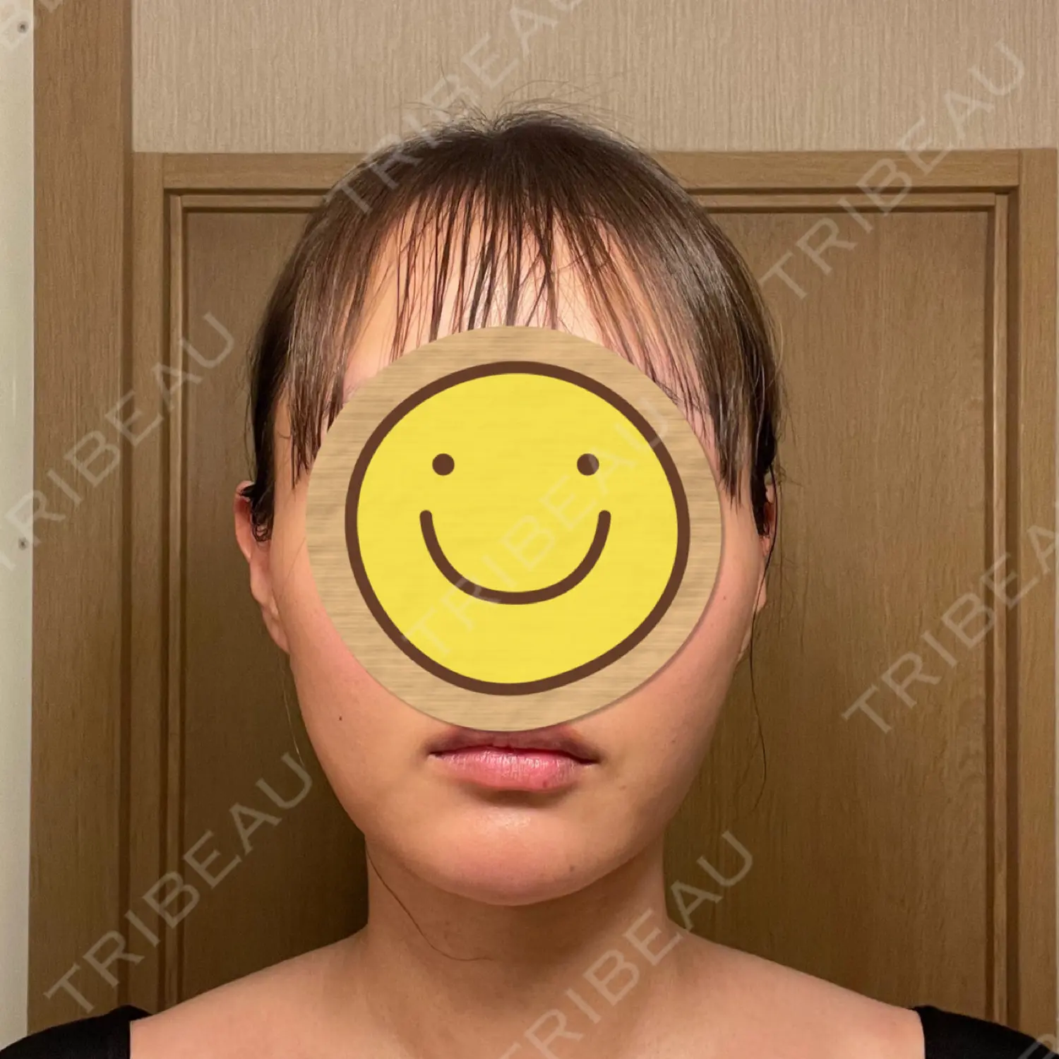 施術後の写真