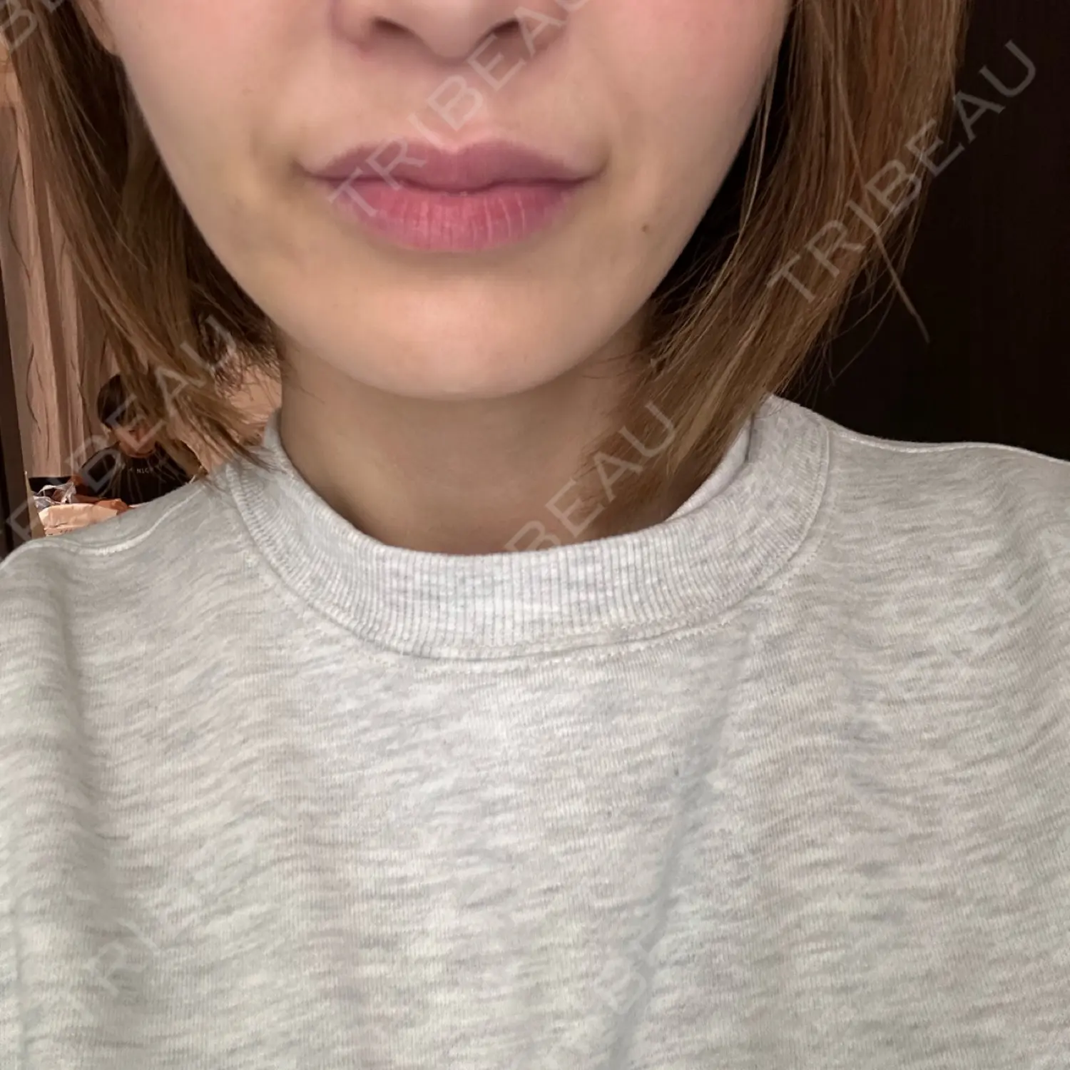 施術後の写真