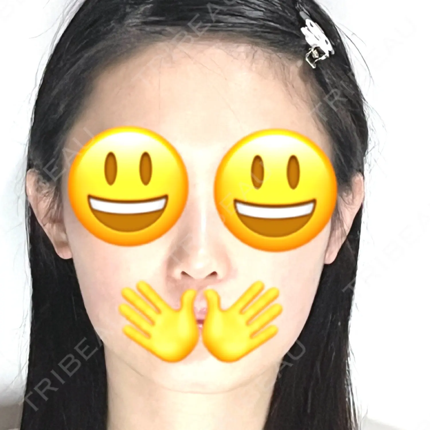 施術後の写真