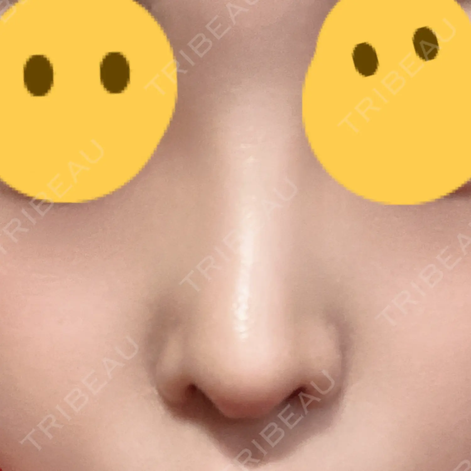 施術後の写真