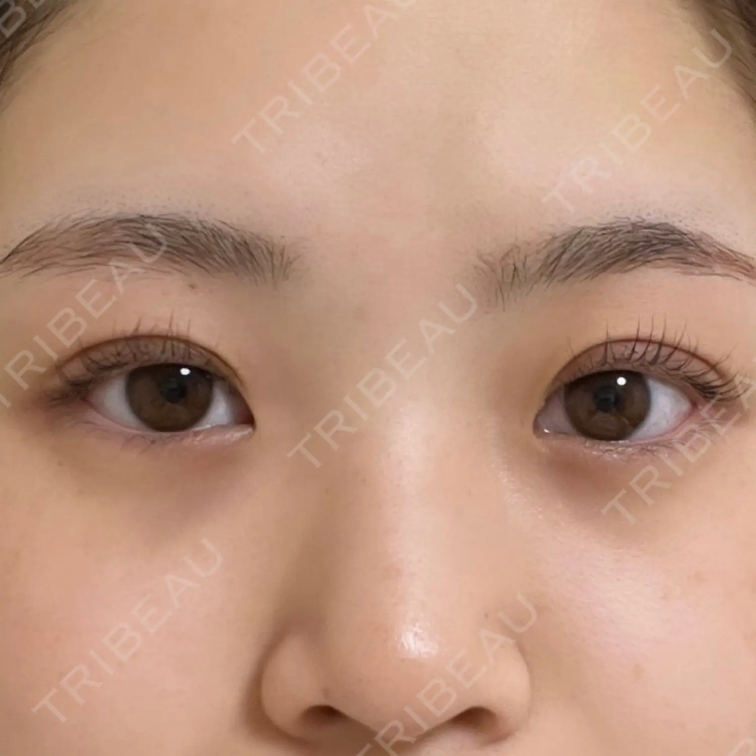 施術後の写真