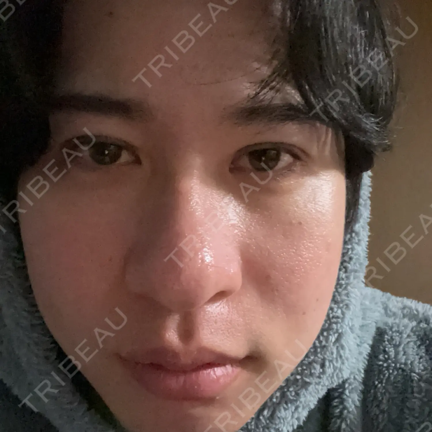 施術後の写真