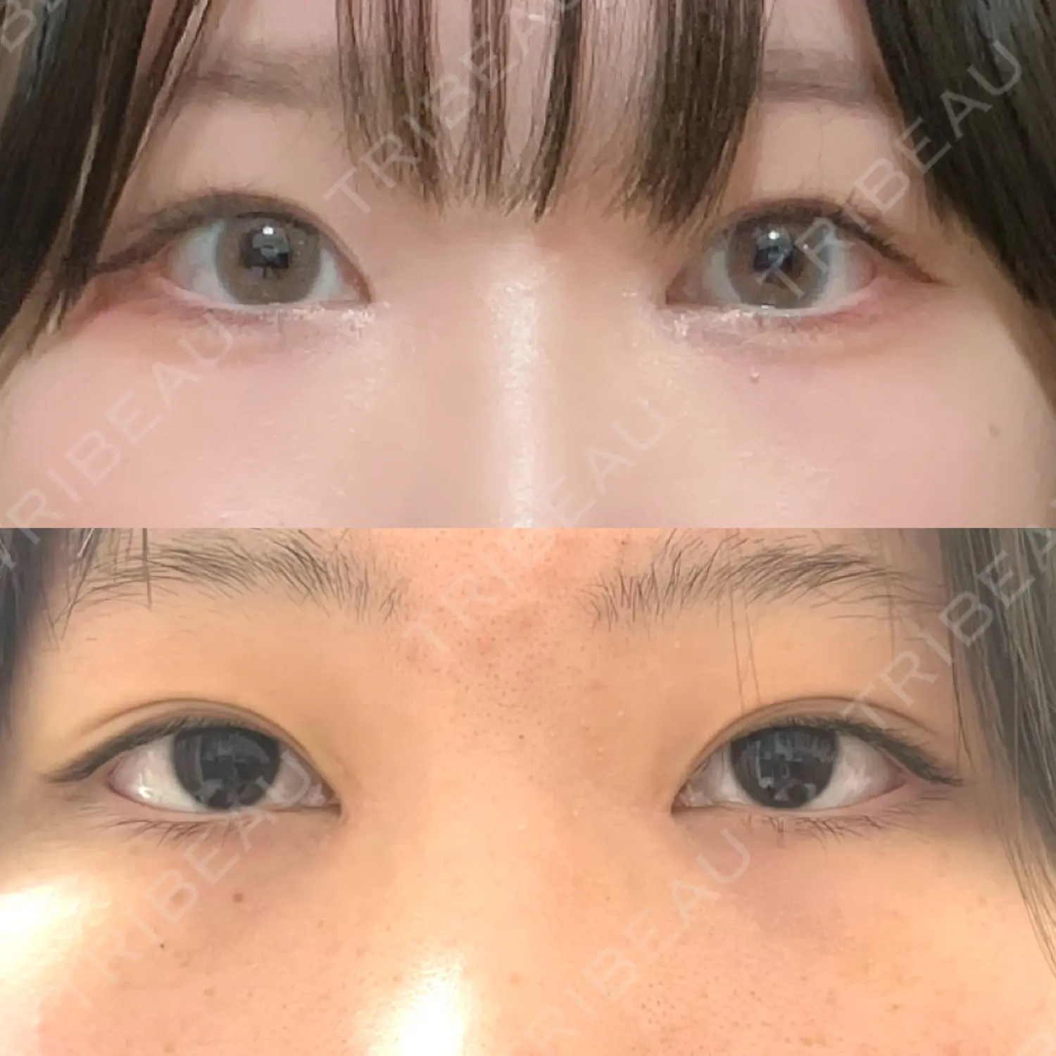 施術後の写真