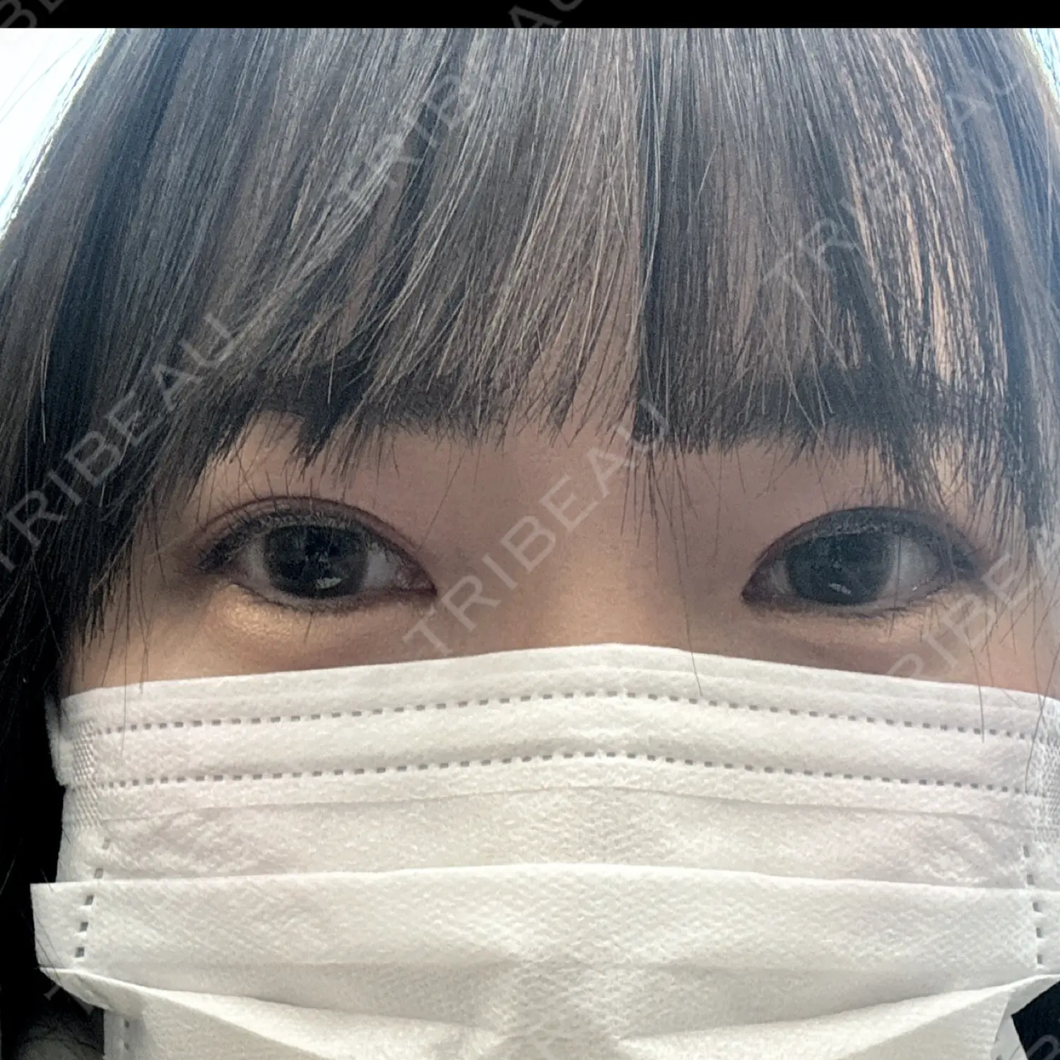 施術後の写真