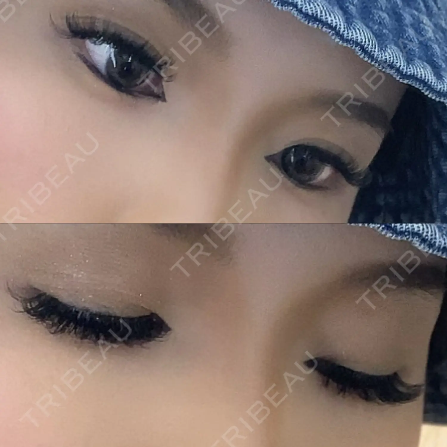 施術後の写真