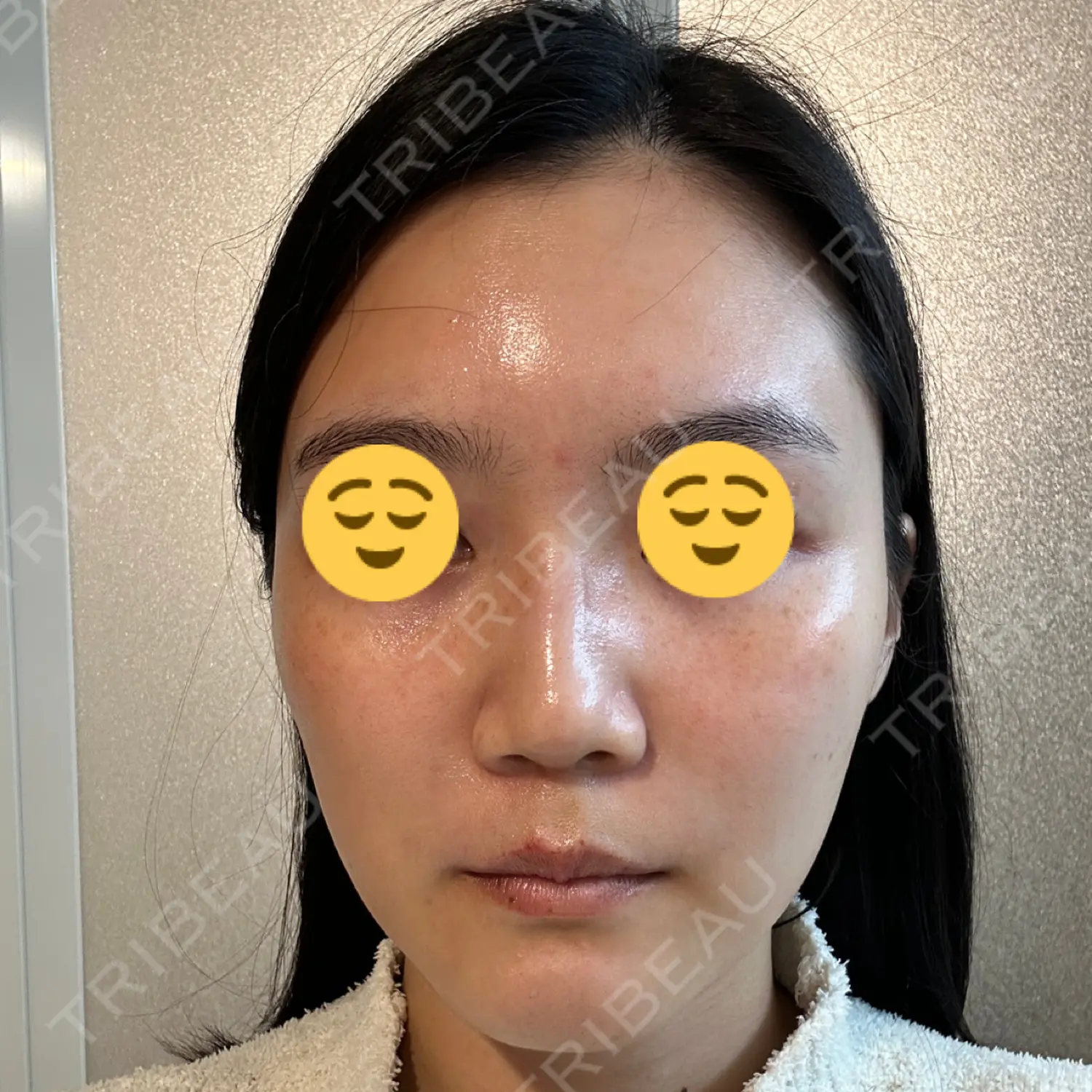 施術後の写真