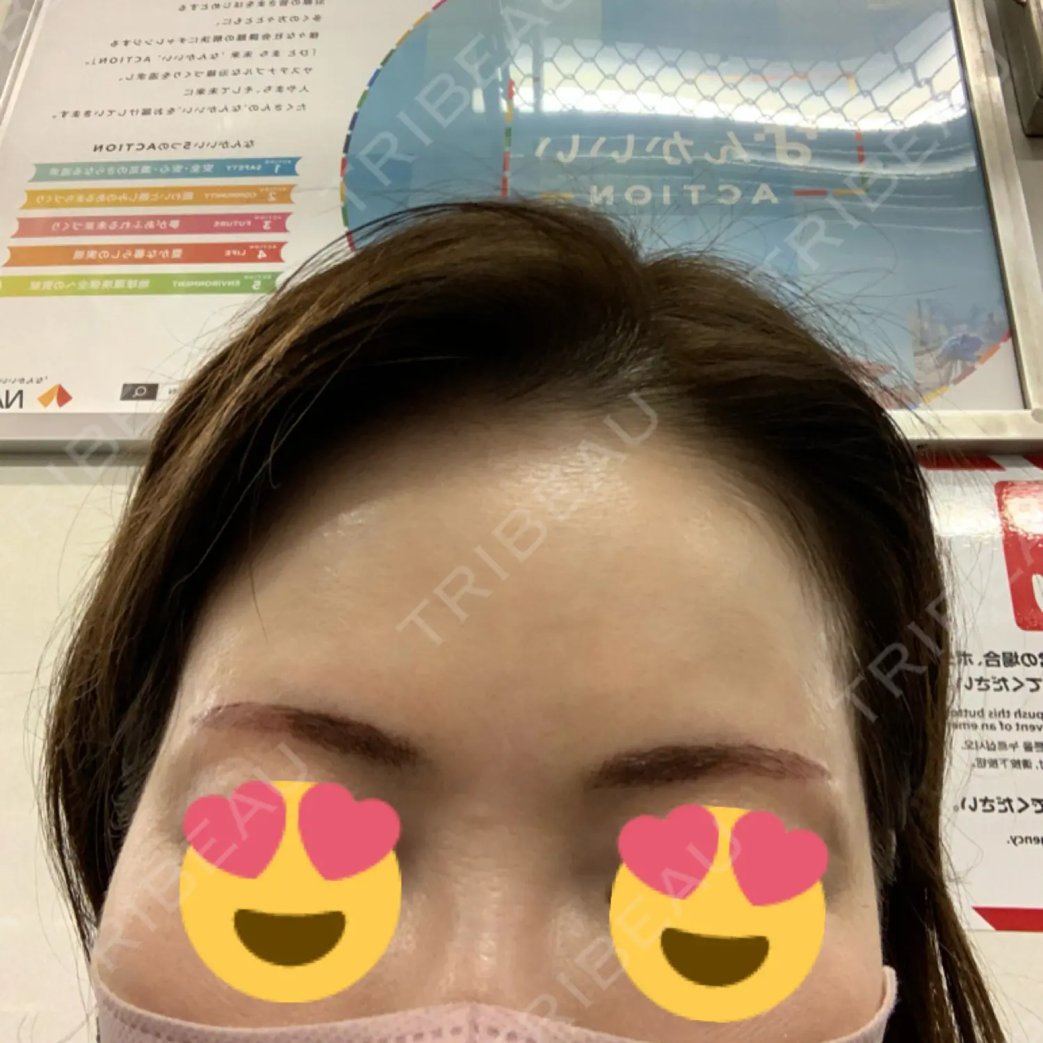 施術後の写真