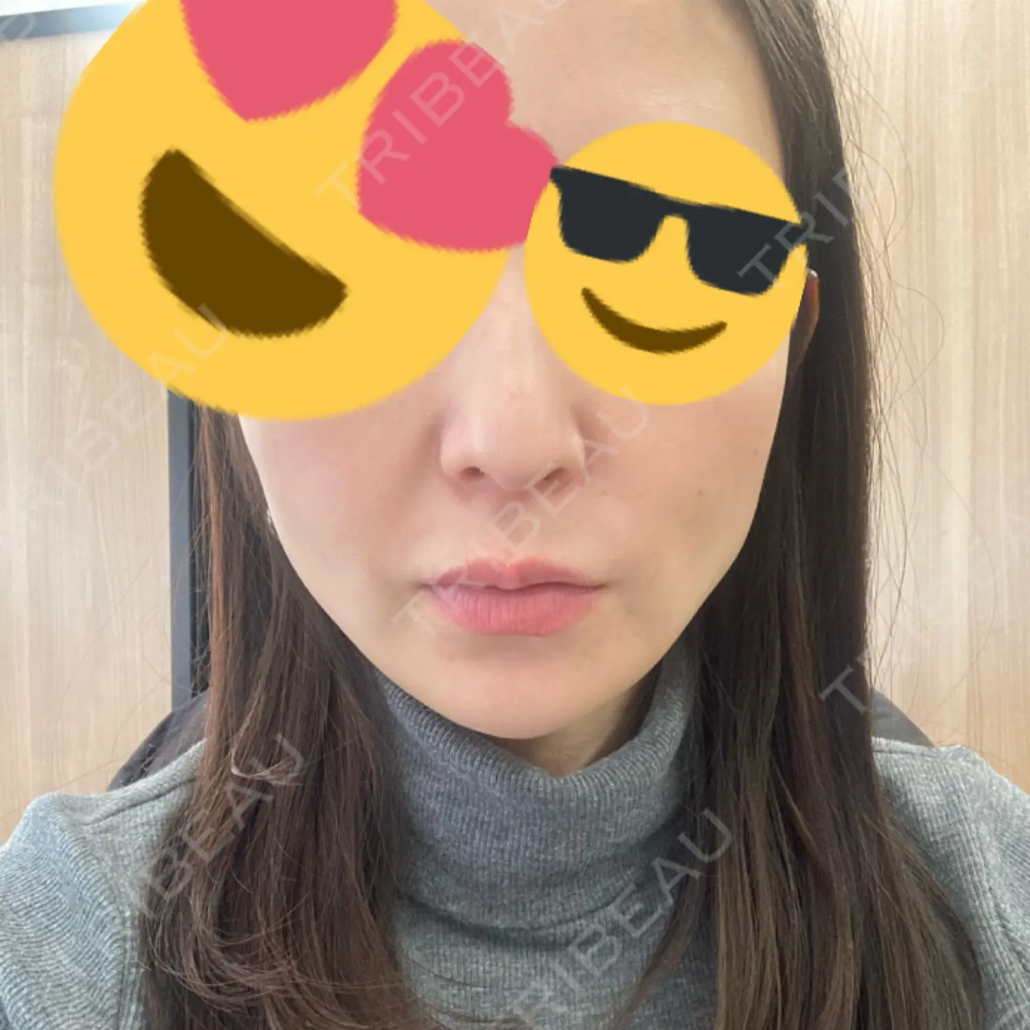 施術後の写真