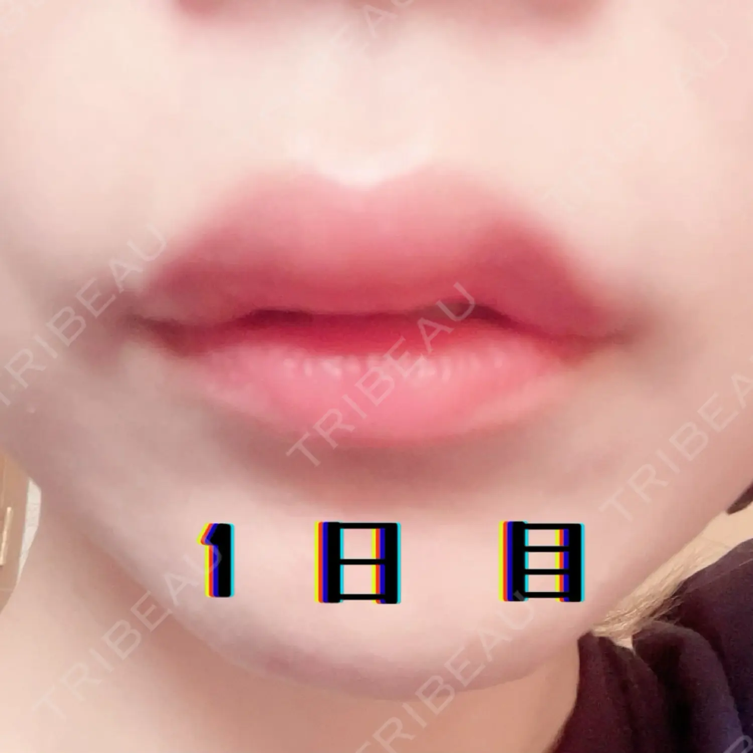 施術後の写真