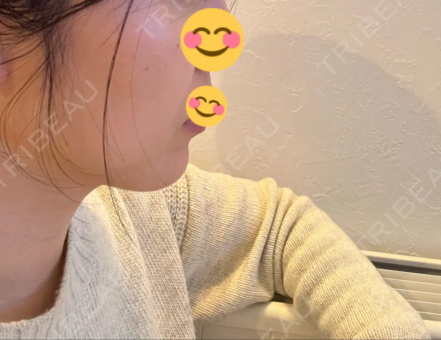 施術後の写真