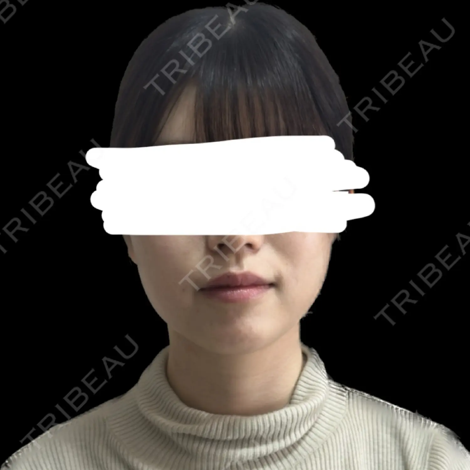 施術後の写真