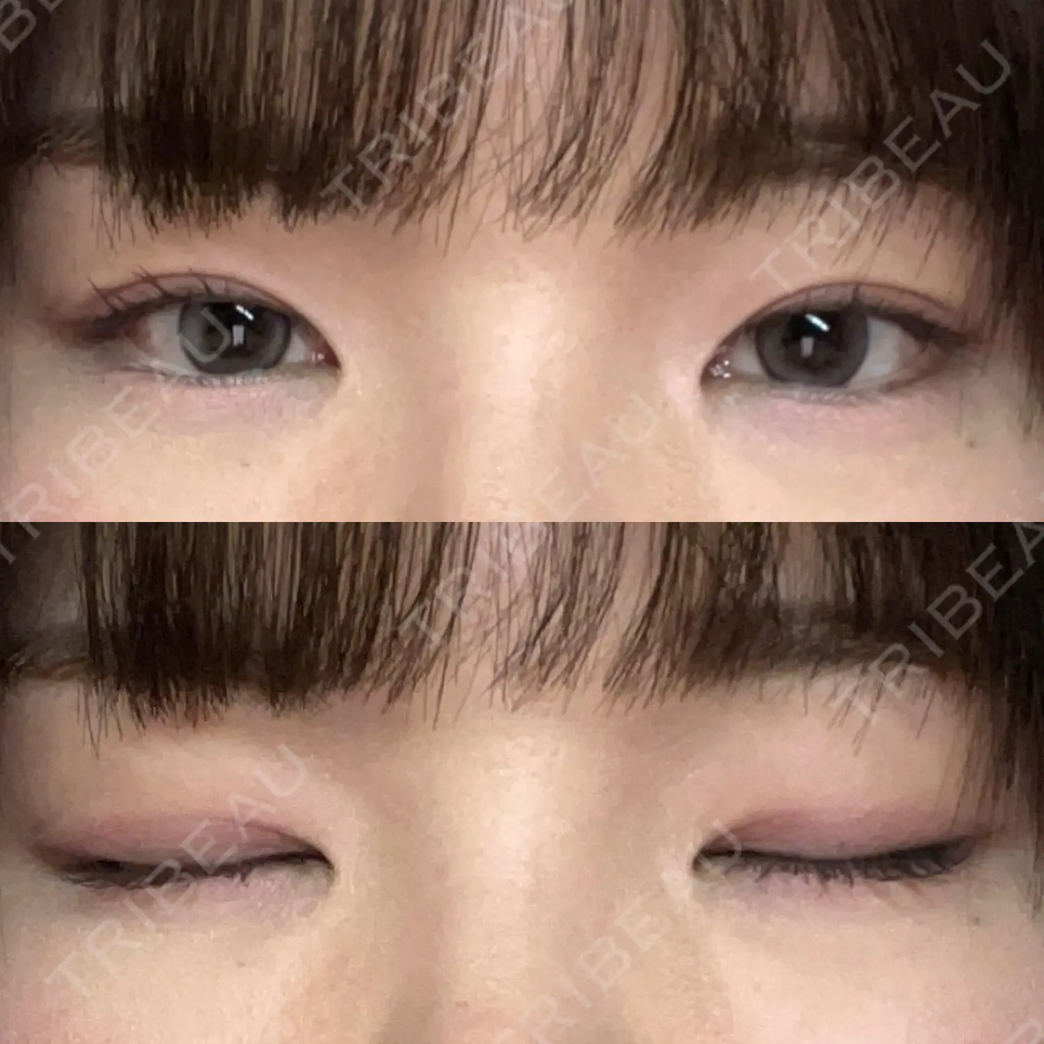 施術後の写真