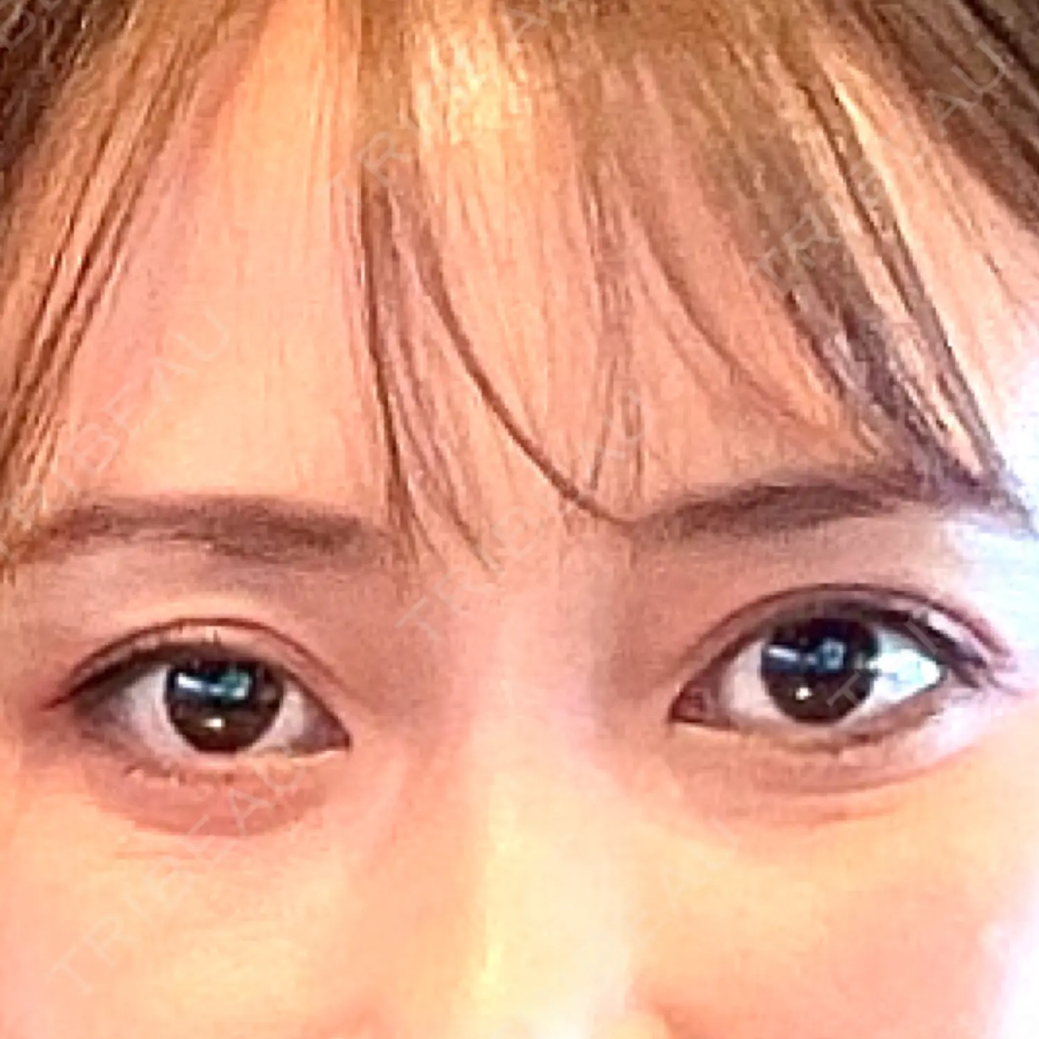 施術後の写真