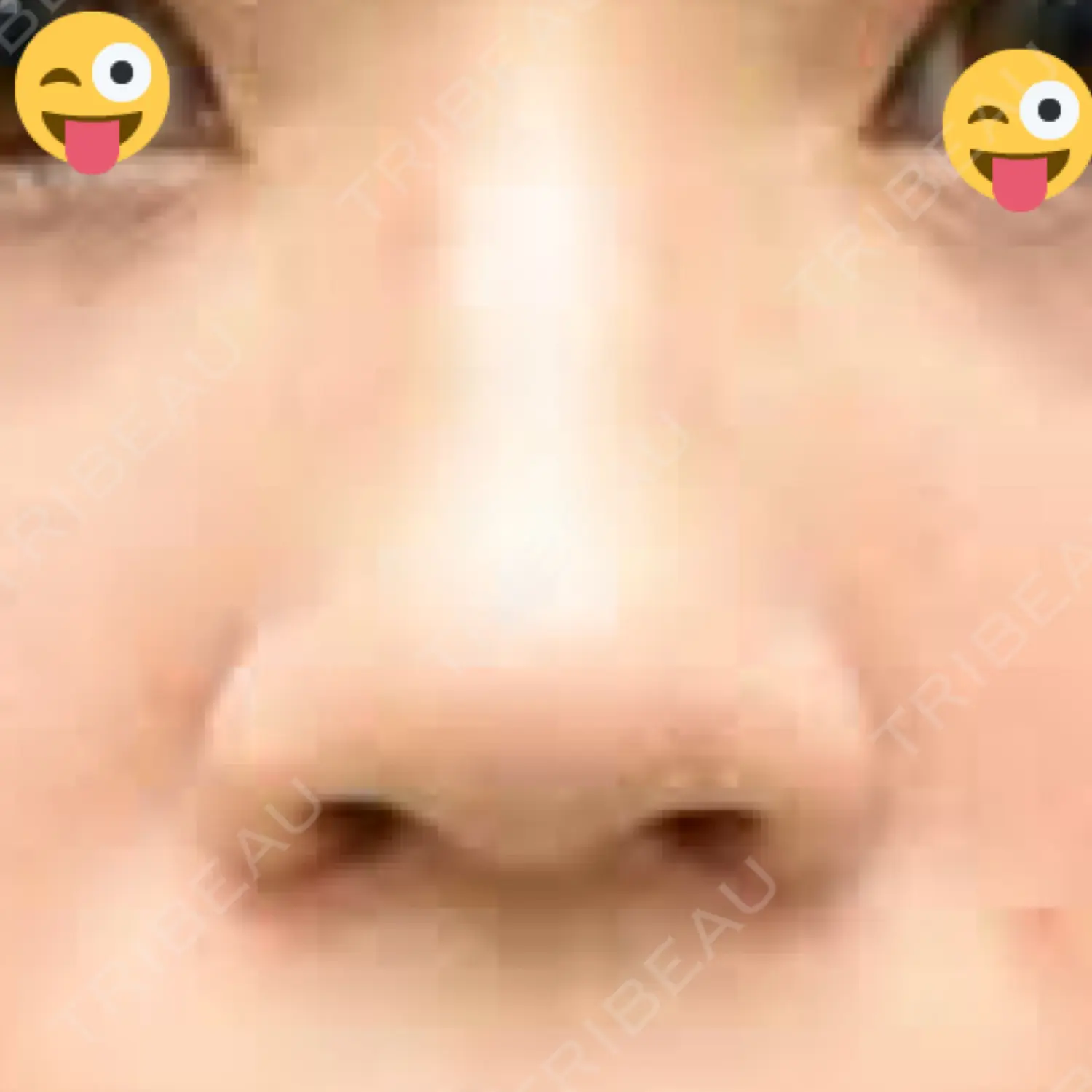 施術後の写真