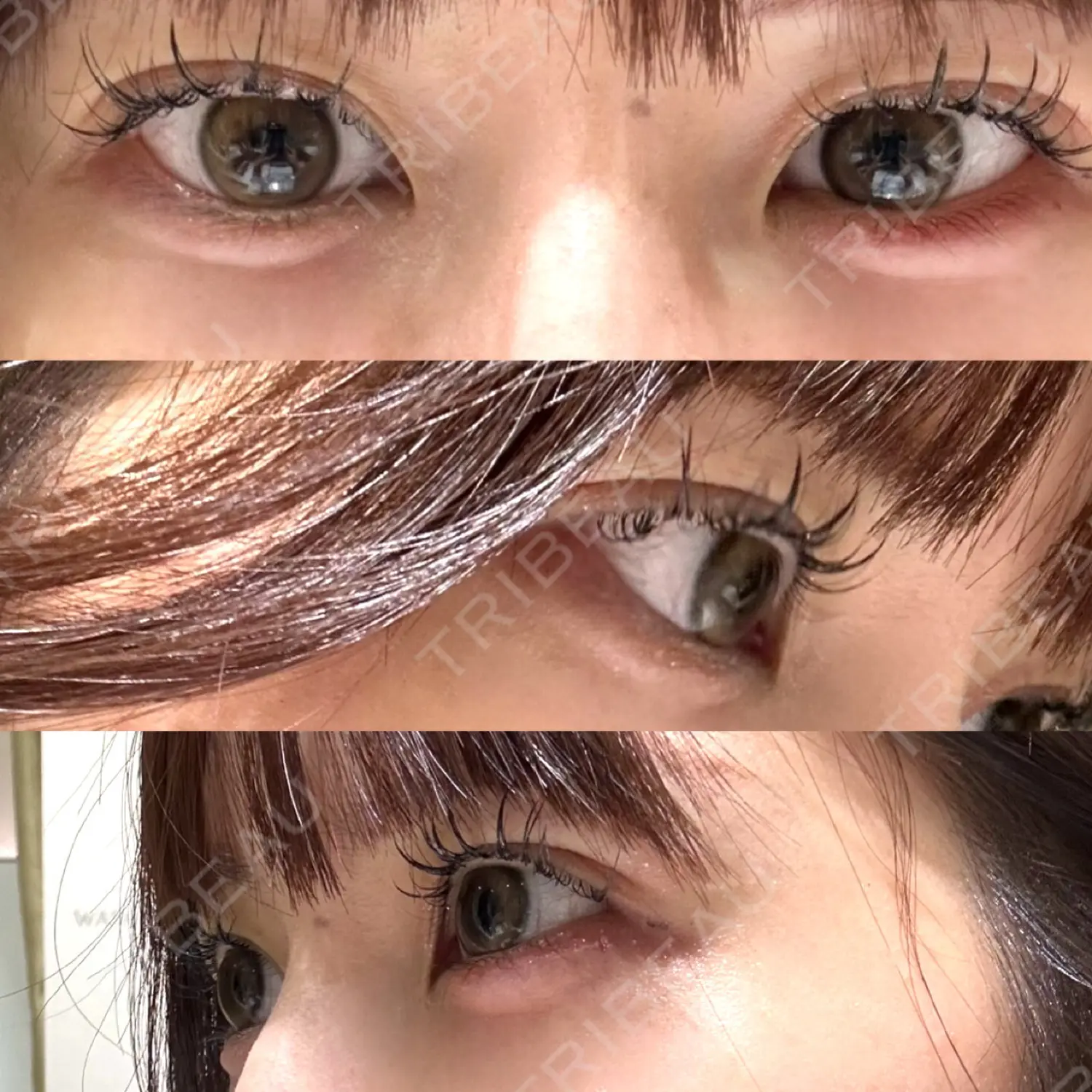施術後の写真