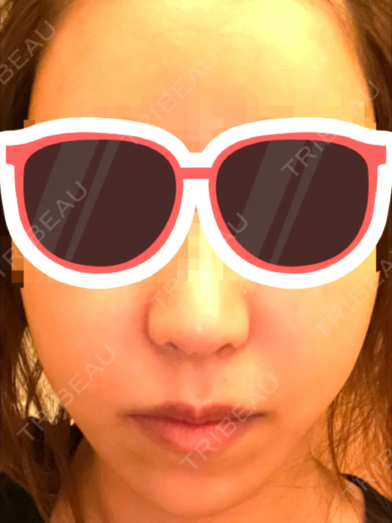 施術後の写真