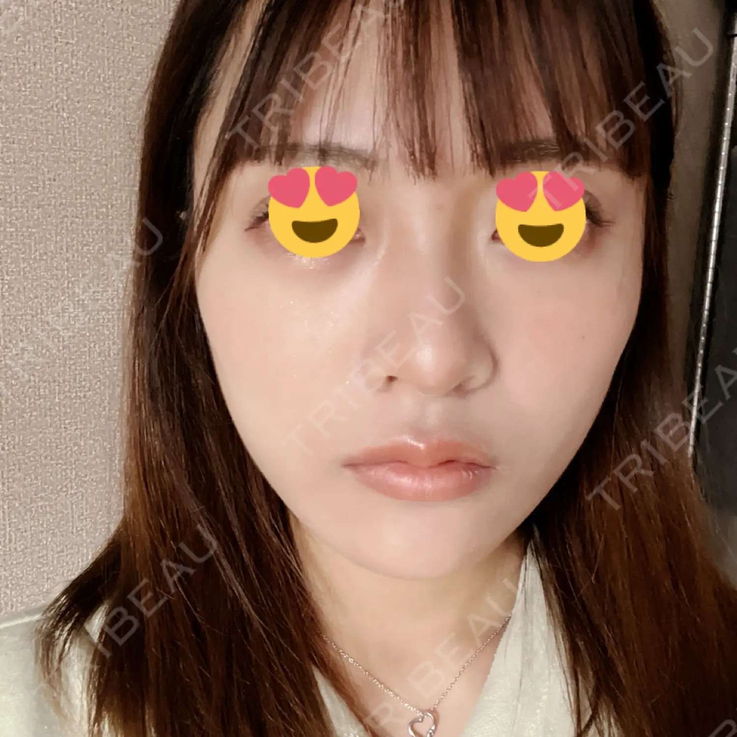 施術後の写真