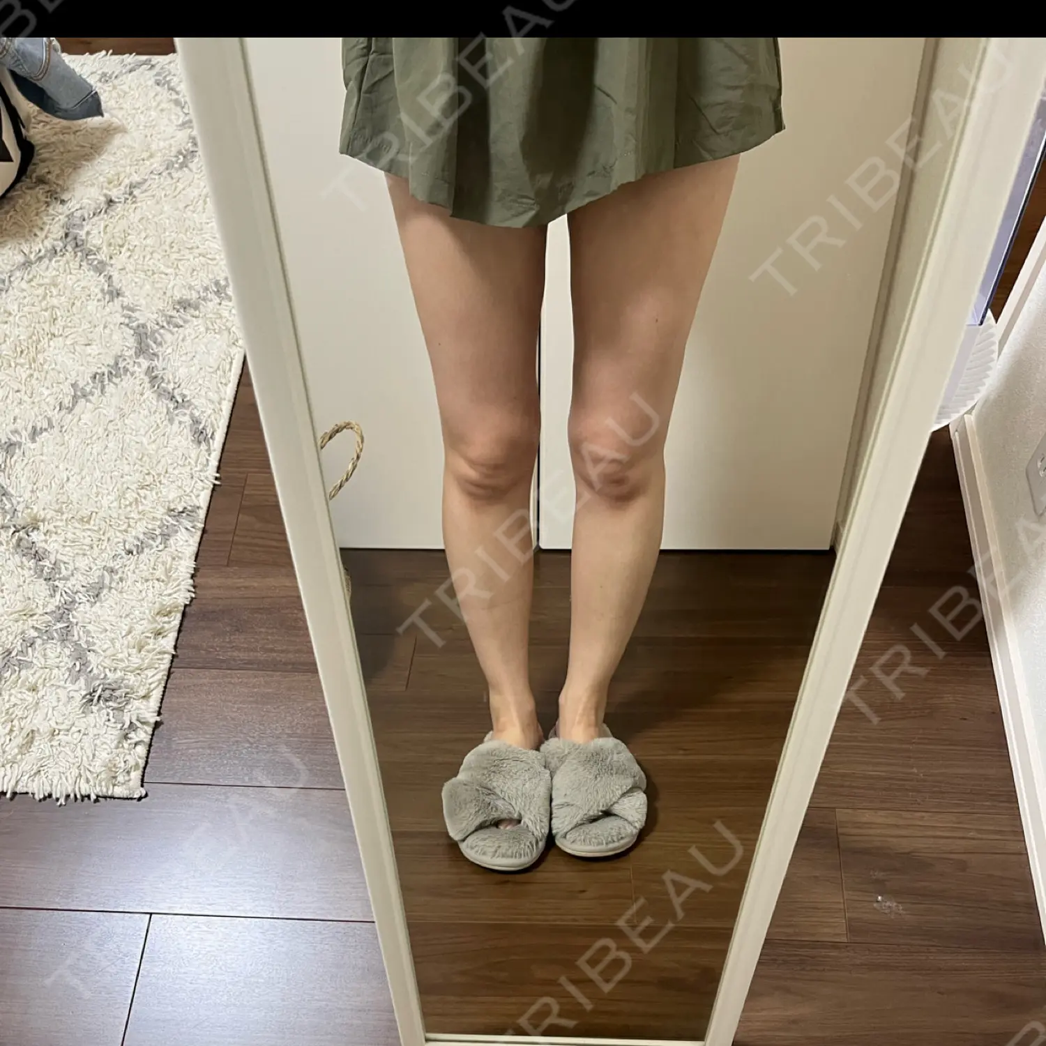 施術後の写真