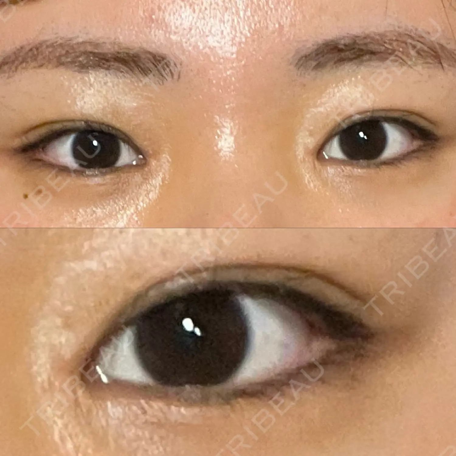 施術後の写真