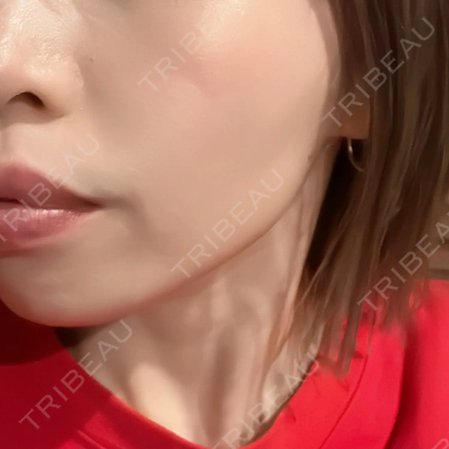 施術後の写真