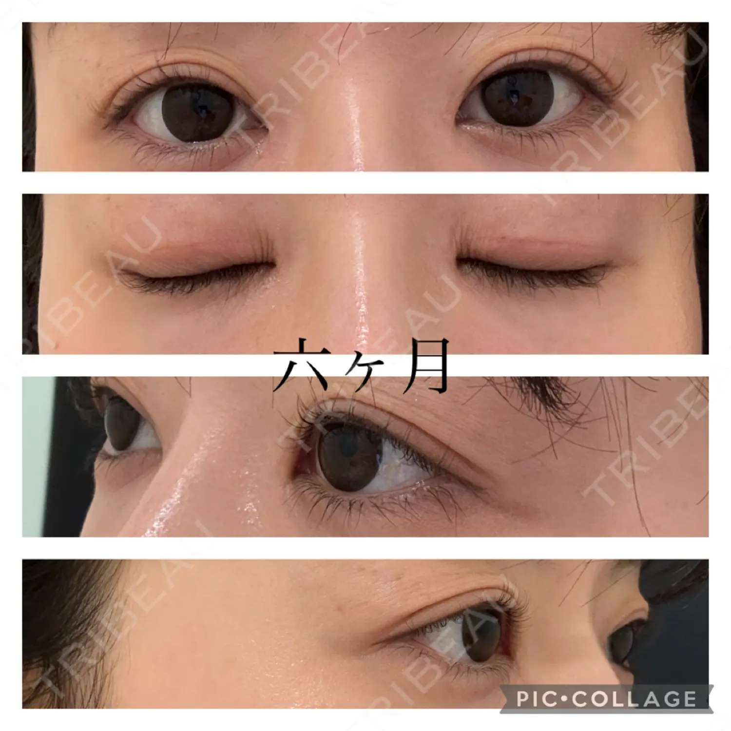 施術後の写真