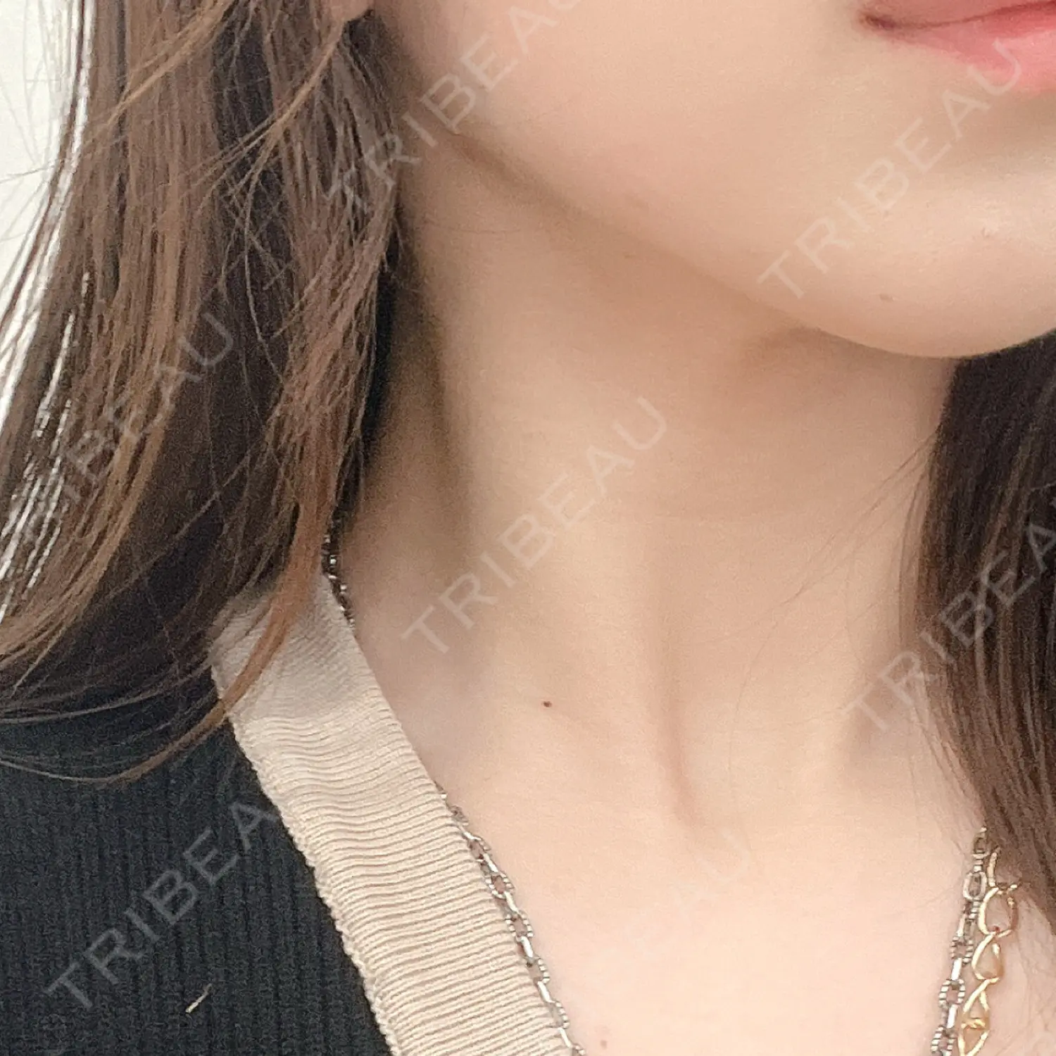 施術後の写真