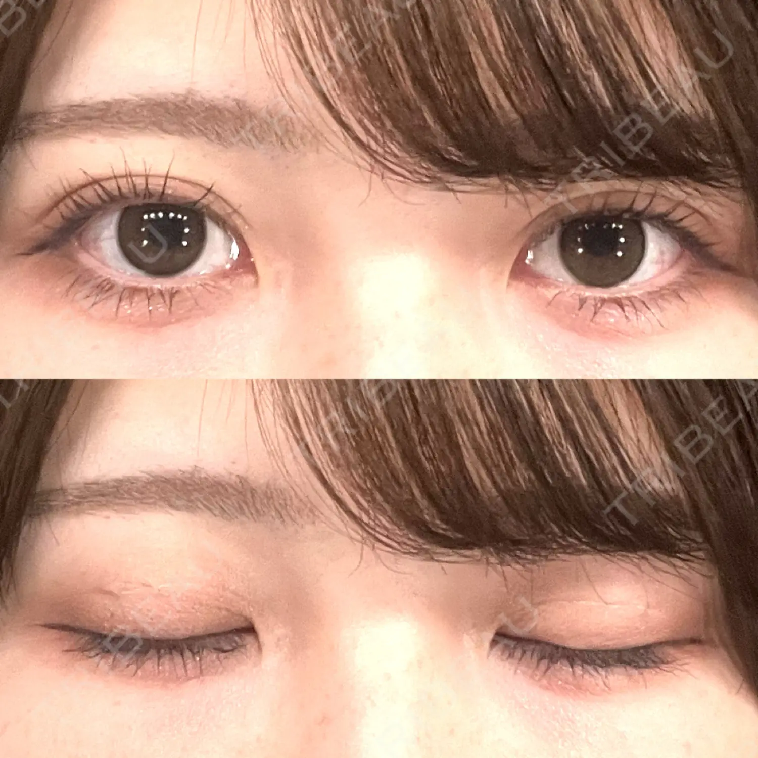施術後の写真