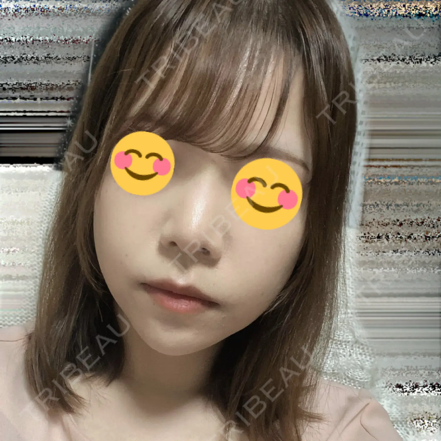 施術後の写真