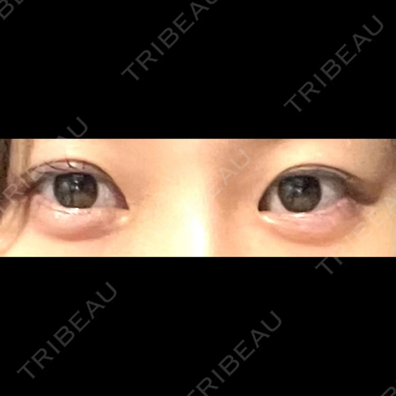 施術後の写真