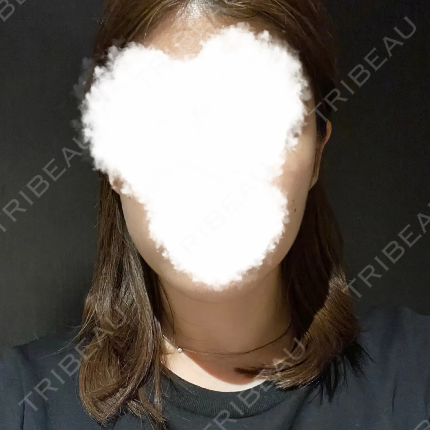 施術後の写真
