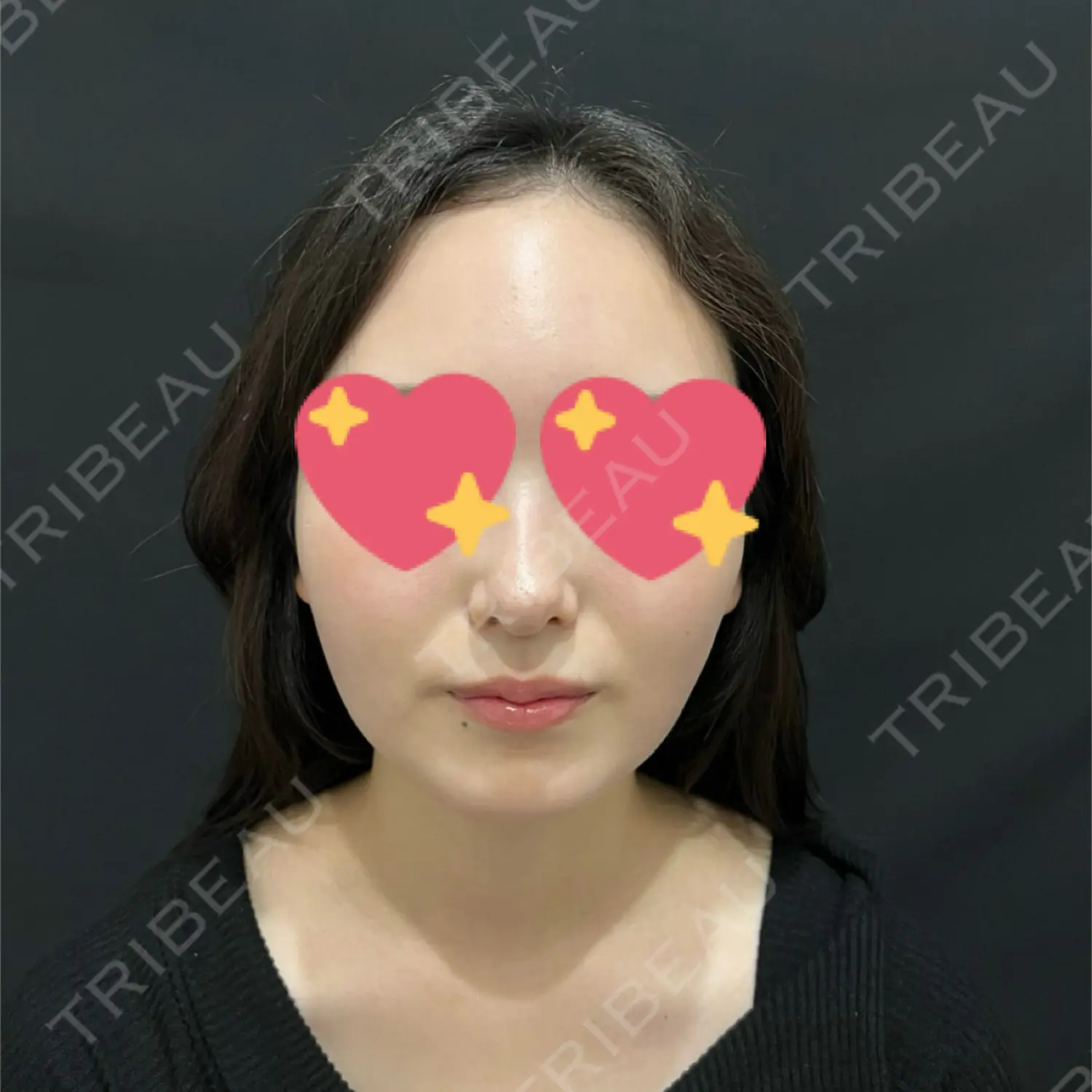 施術後の写真