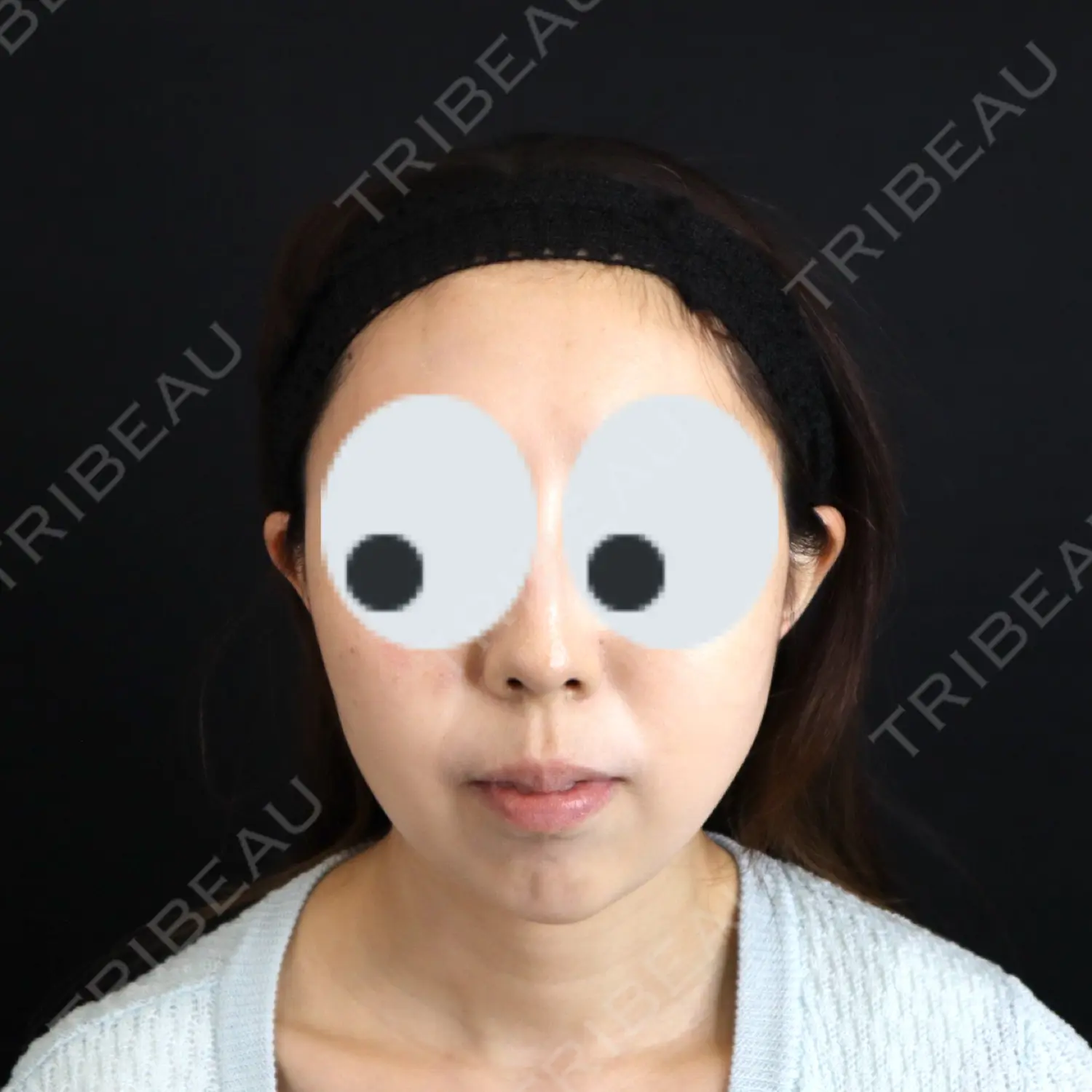 施術後の写真