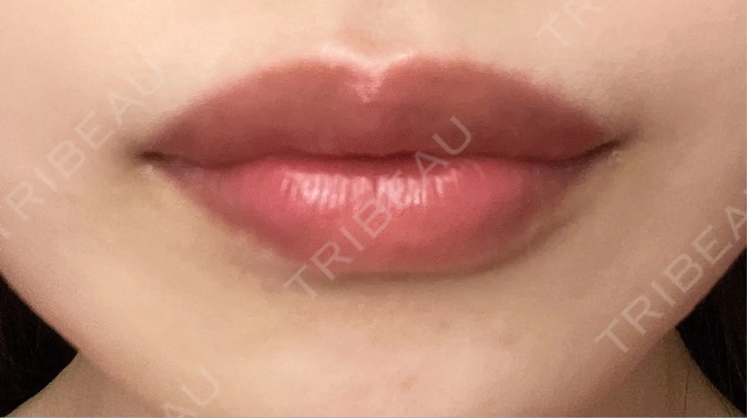 施術後の写真