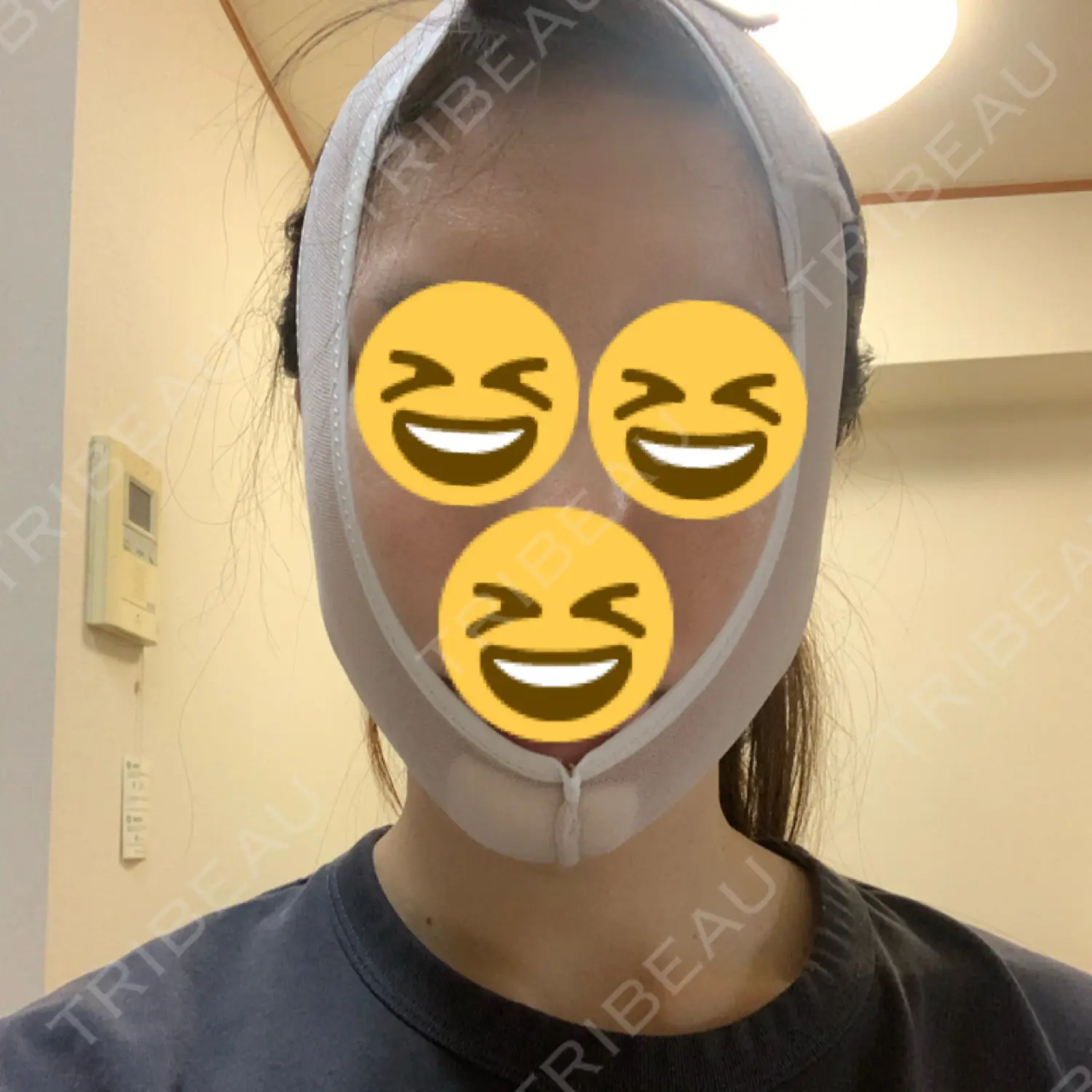 施術後の写真