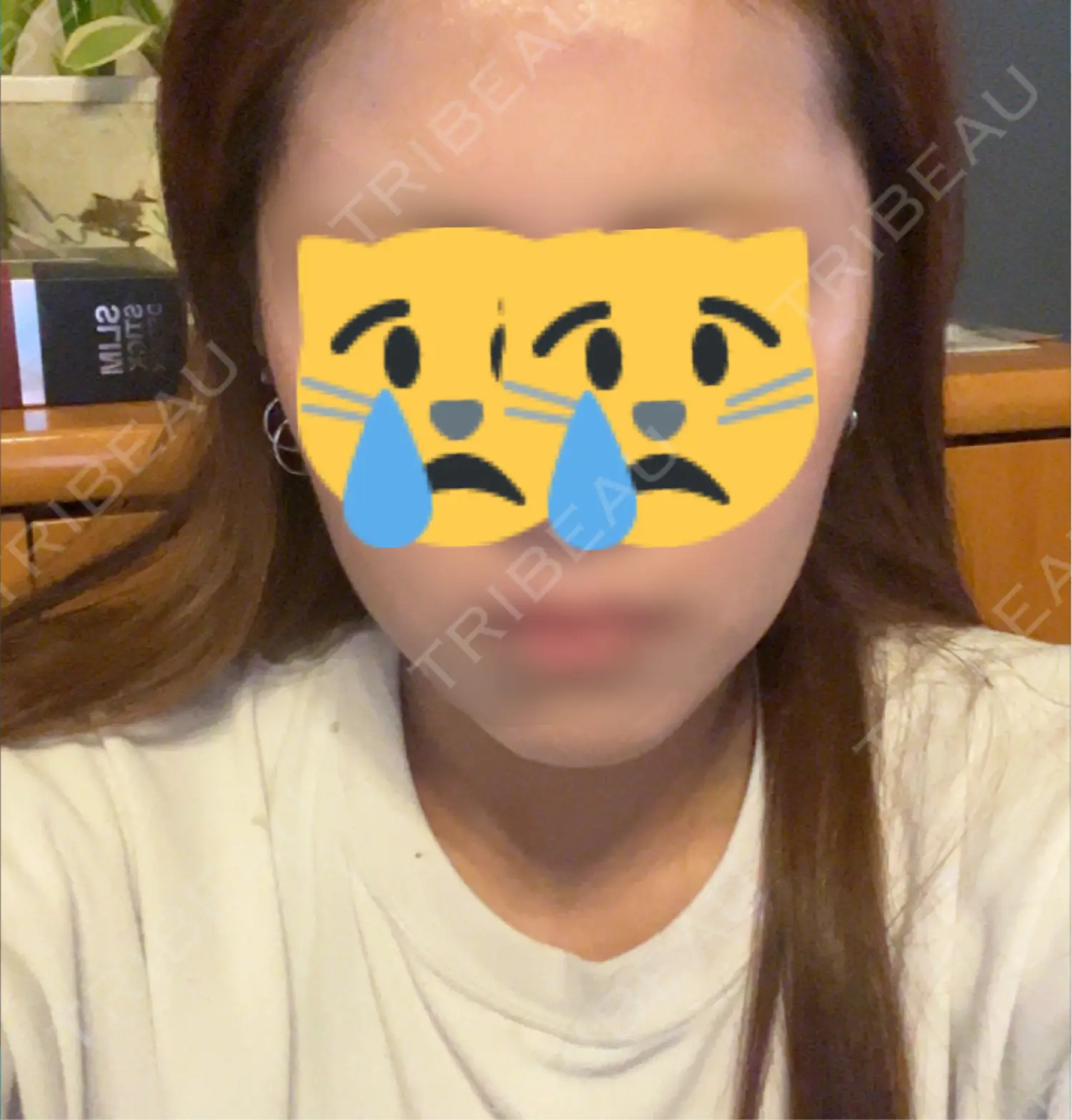 施術後の写真