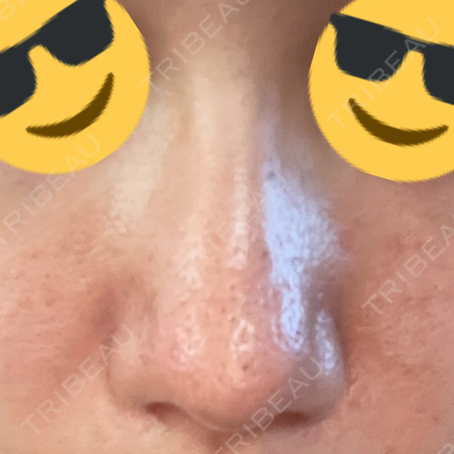 施術後の写真