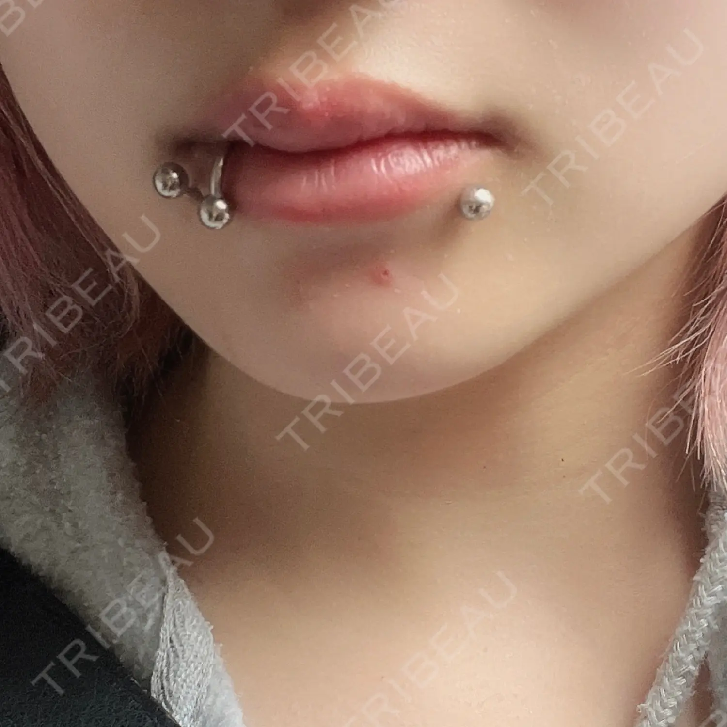 施術後の写真