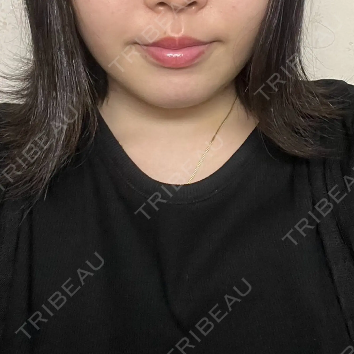 施術後の写真