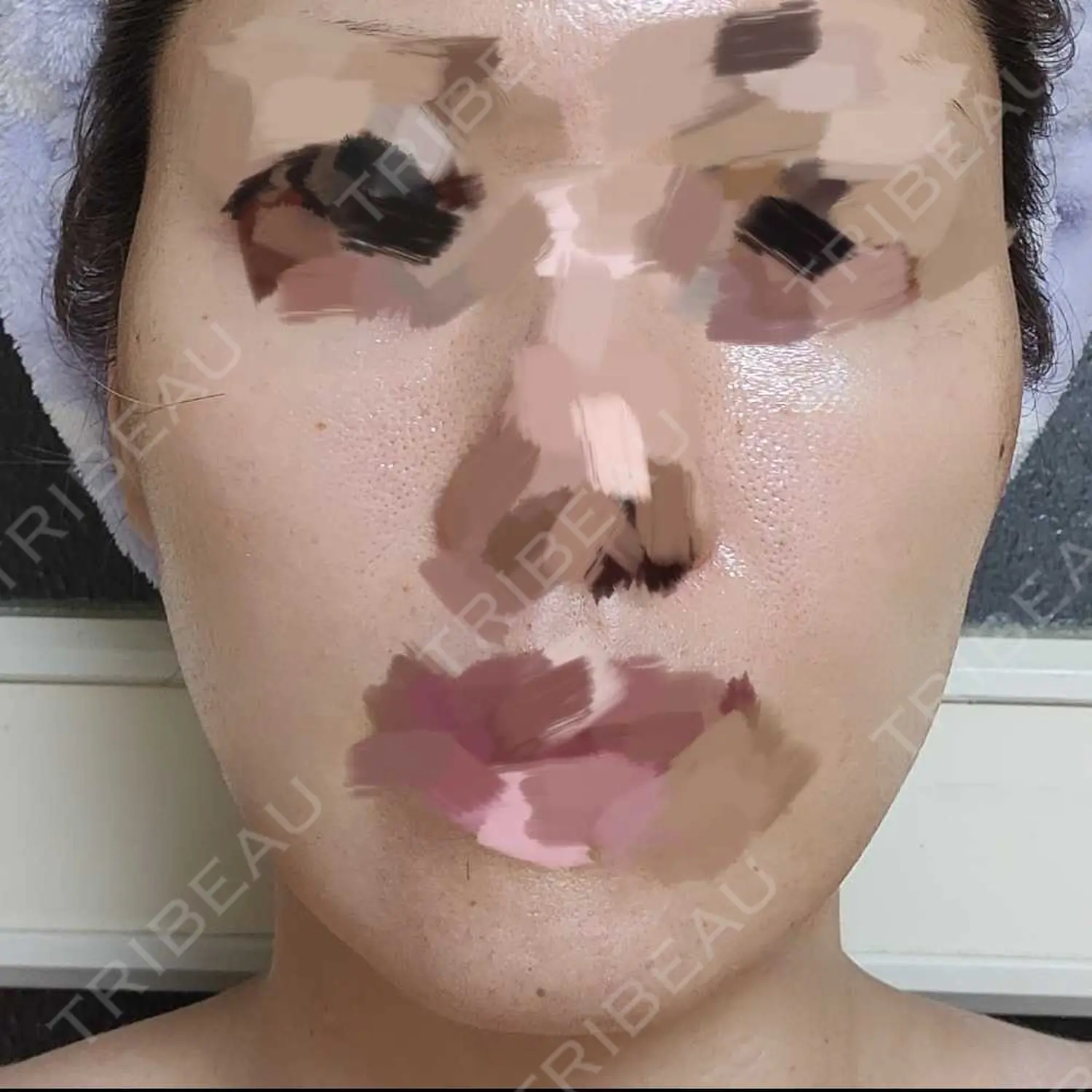 施術後の写真