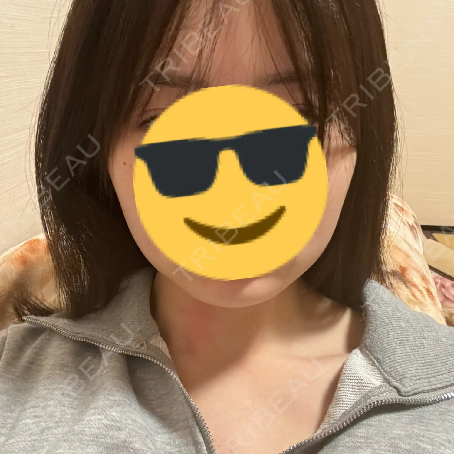 施術後の写真
