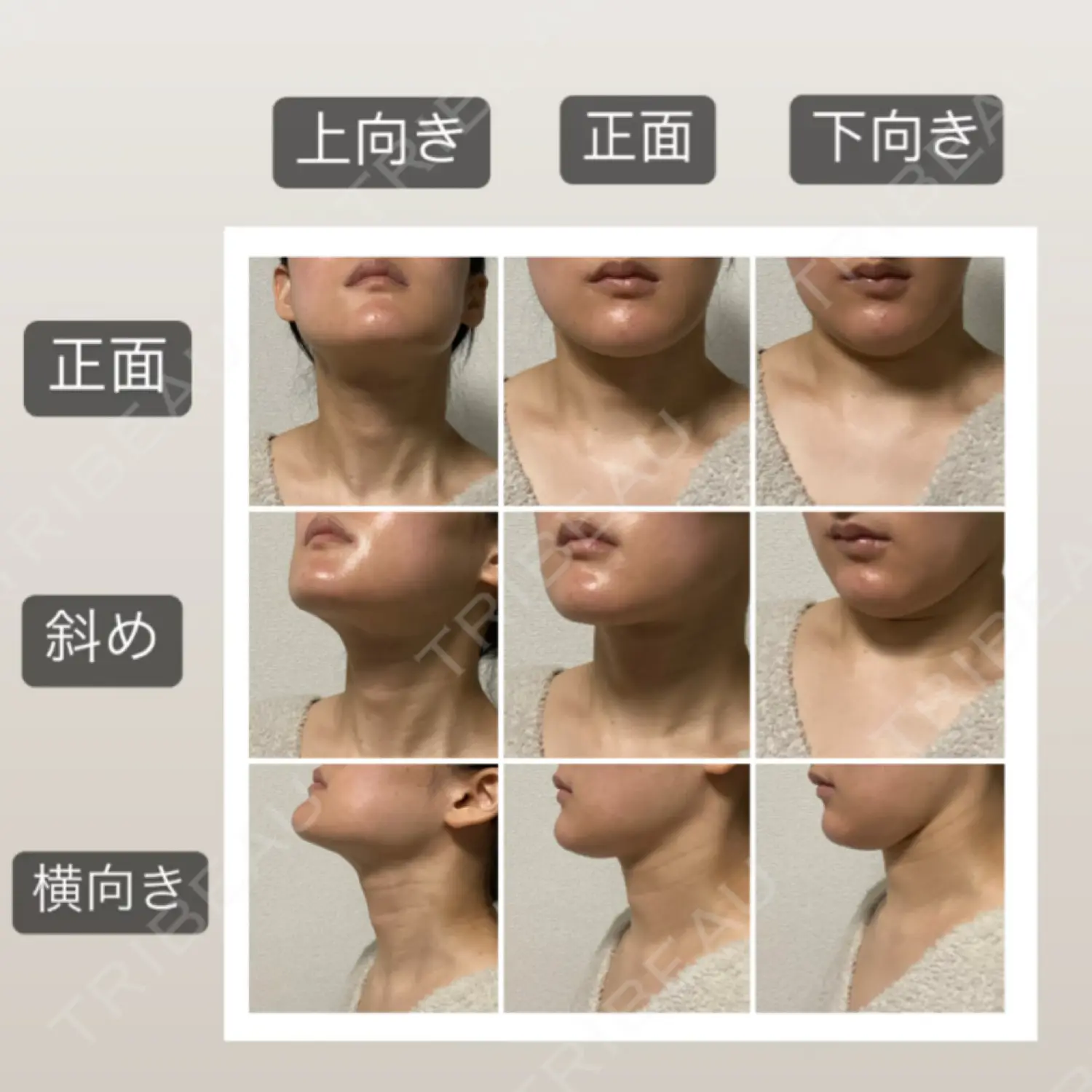 施術後の写真