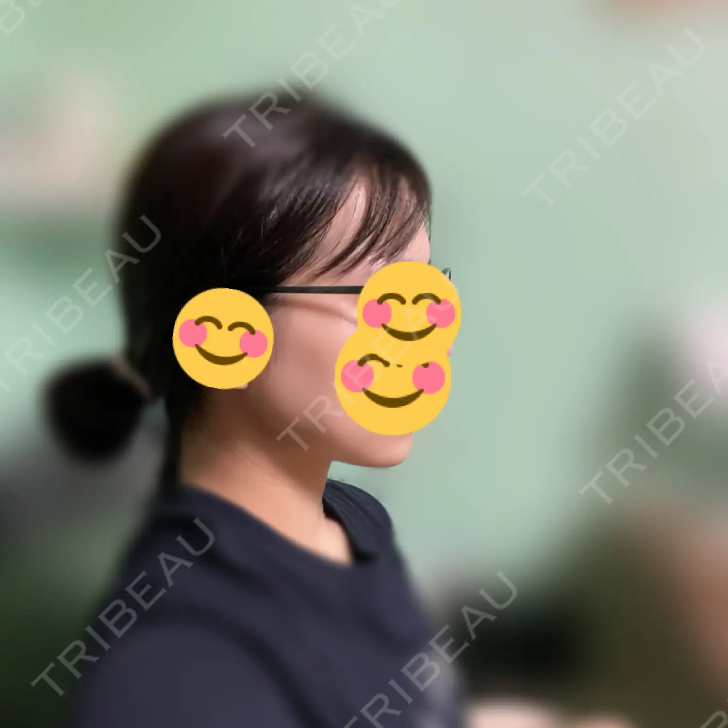 施術後の写真