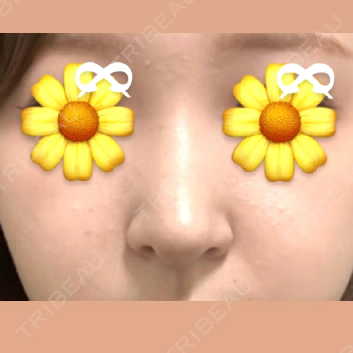 施術後の写真