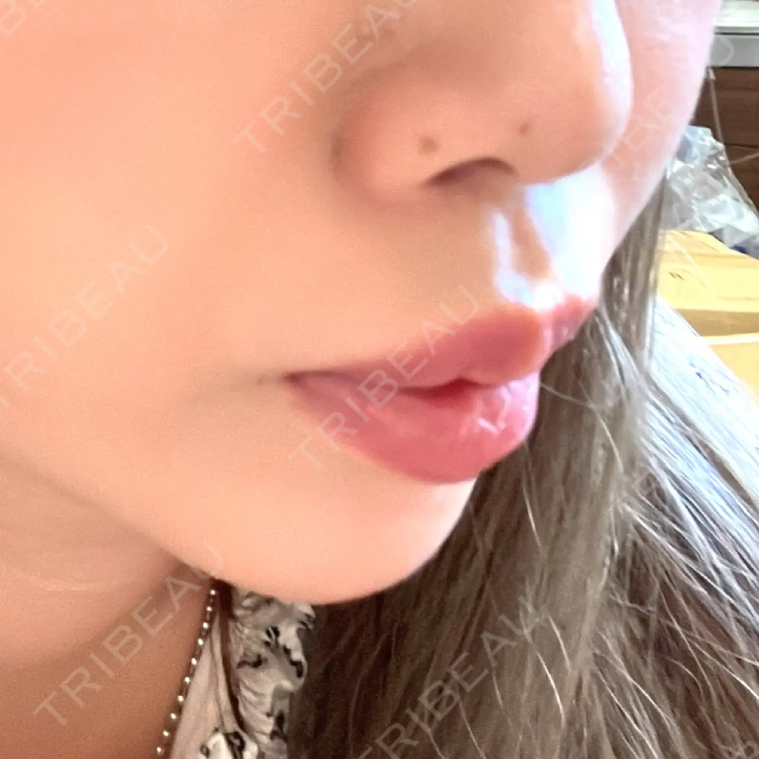 施術後の写真
