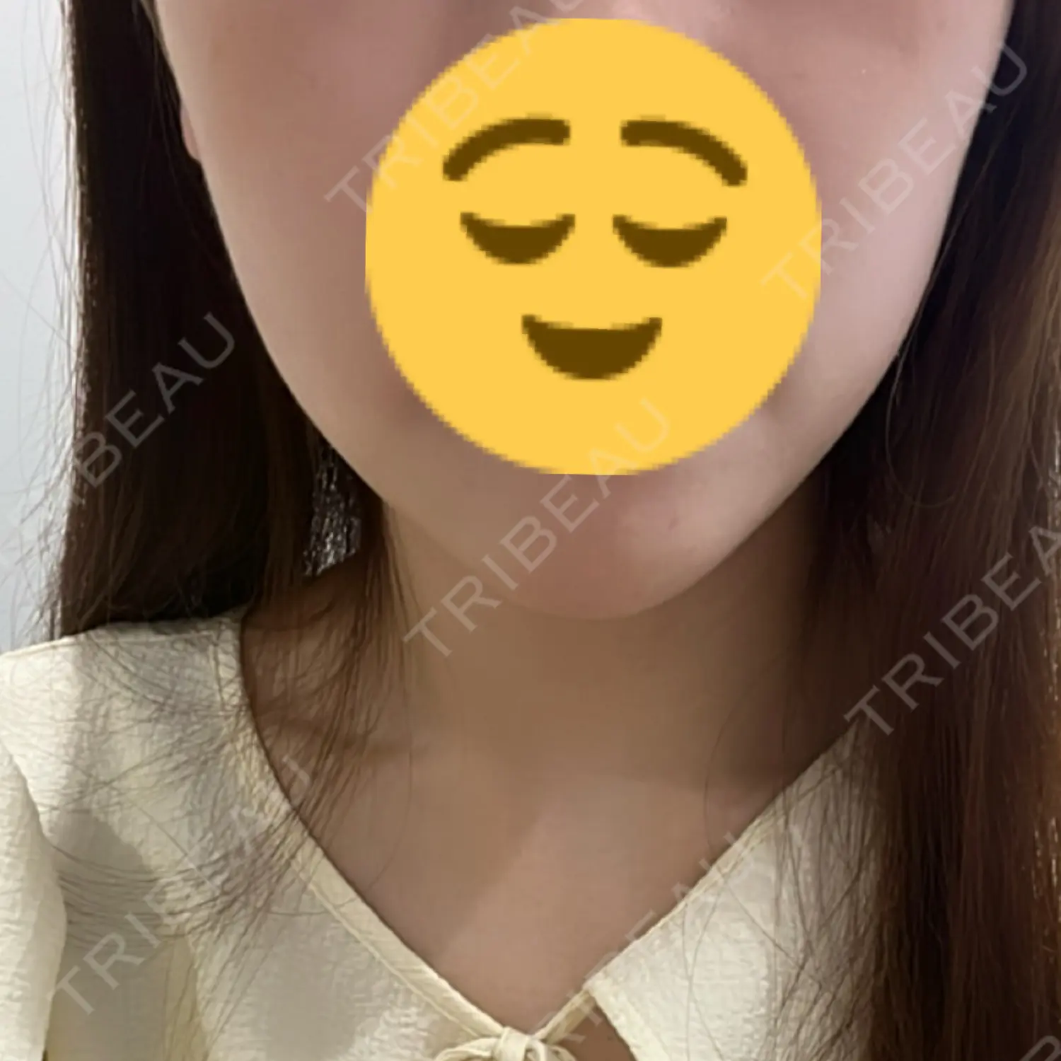施術後の写真