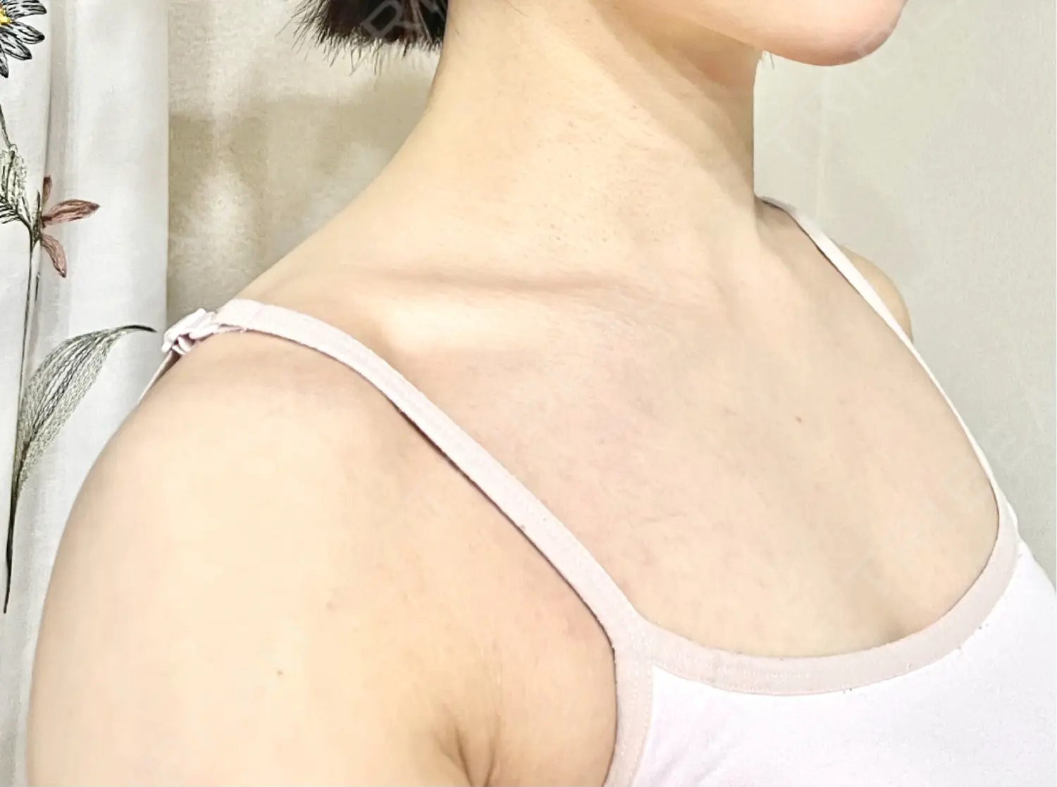 施術後の写真