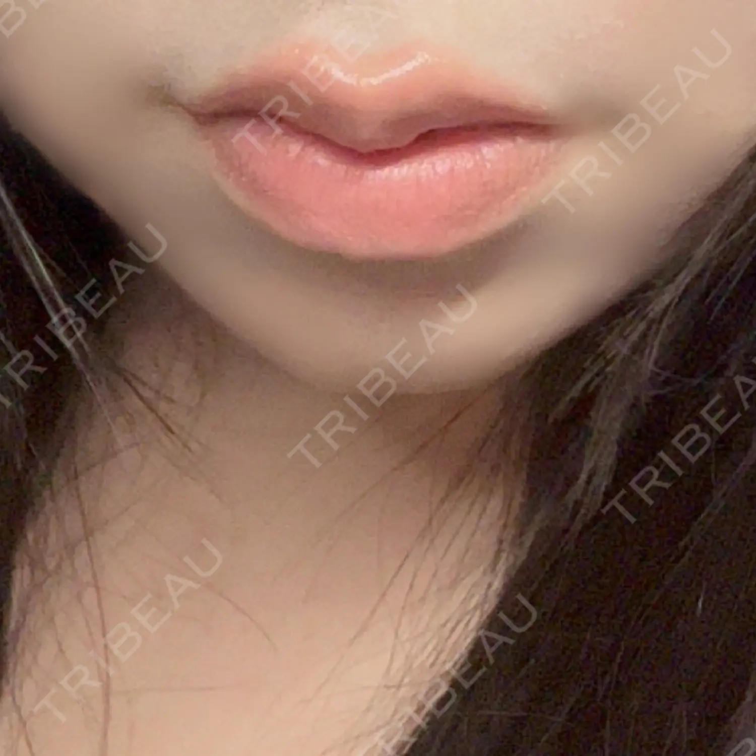 施術後の写真