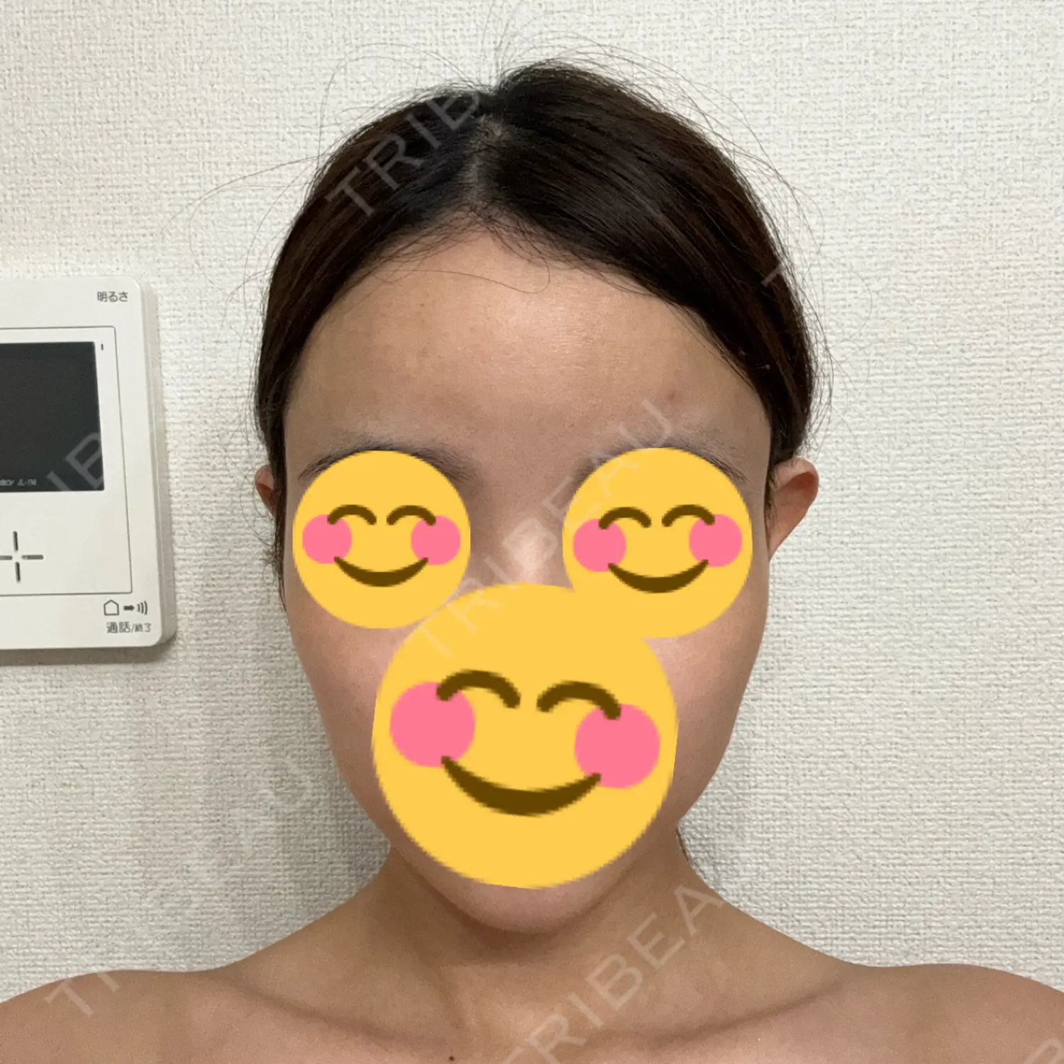 施術後の写真