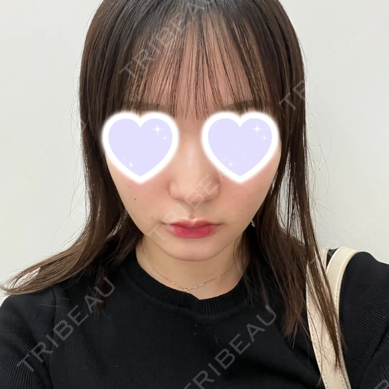 施術後の写真