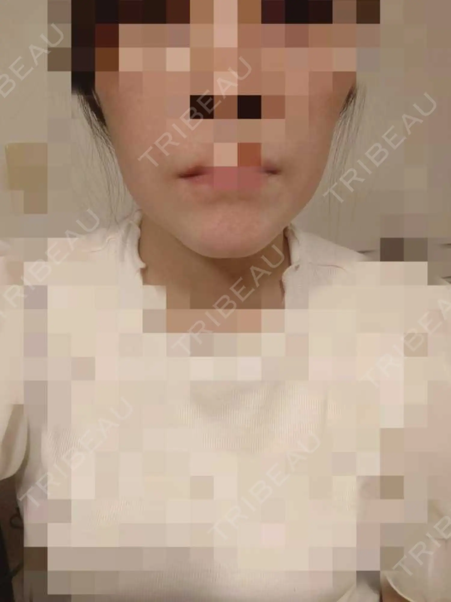 施術後の写真